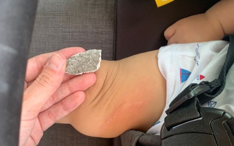Bimbo di sette mesi colpito da calcinaccio caduto da un palazzo